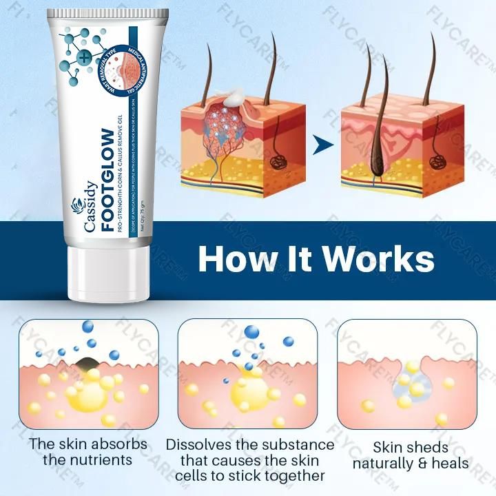 CASSIDY FootGlow Remove Gel – Smooth, Heal & Brighten Your Feet (75g x Pack of 2)